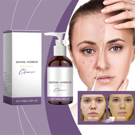 Diamond Peel 101: Gentle Exfoliation Without the Irritation.